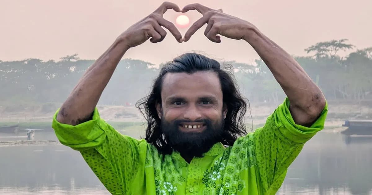 পেট্রল দিয়ে কনটেন্ট বানাতে গিয়ে দগ্ধ কনটেন্ট ক্রিয়েটর