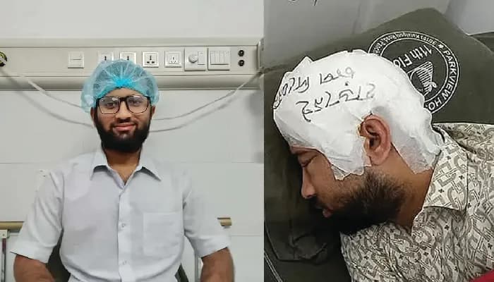 চবি শিক্ষার্থী মামুনের মাথায় প্রতিস্থাপিত হলো সংরক্ষিত খুলি