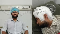 চবি শিক্ষার্থী মামুনের মাথায় প্রতিস্থাপিত হলো সংরক্ষিত খুলি