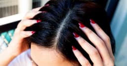 খুশকি দূর করতে শুধু শ্যাম্পুই যথেষ্ট নয়