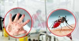 মৌলভীবাজারে হাম ও ডেঙ্গুর দাপট, ৯ মাসে ১৫ শিশুর মৃত্যু