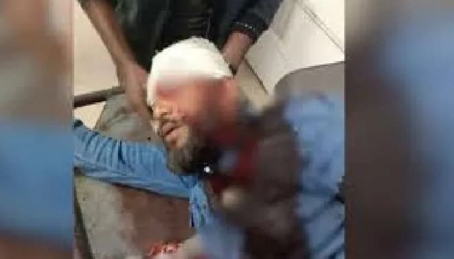 এবার এনসিপি নেতার মাথায় প্রকাশ্যে গুলি