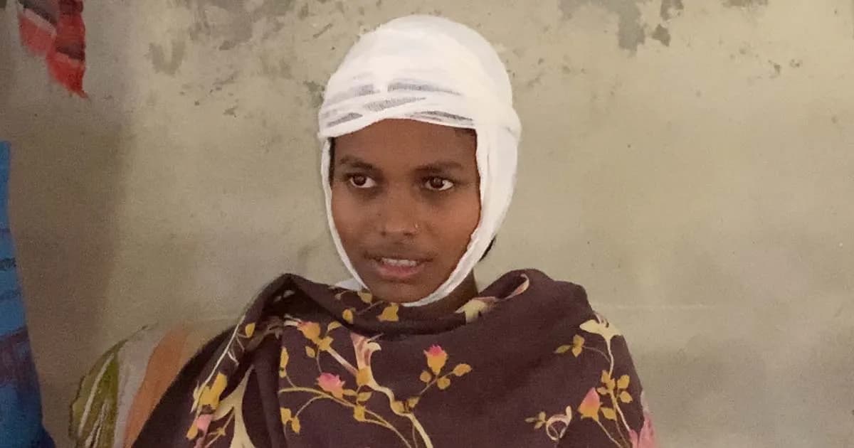 ছাত্রীর মাথা ফাটালেন প্রধান শিক্ষক!