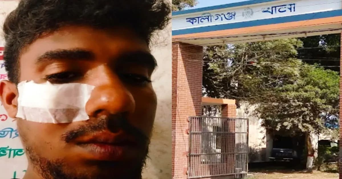 কালীগঞ্জে সাংবাদিক সংগঠনের সদস্যের ওপর হামলা