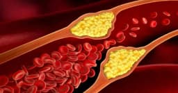 অতিরিক্ত কোলেস্টেরল কমানোর সহজ উপায়