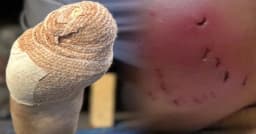 গাজার ধ্বংসস্তূপে নতুন আতঙ্ক, ঘুমন্ত মুসলিমদের কামড়ে খাচ্ছে ইঁদুর