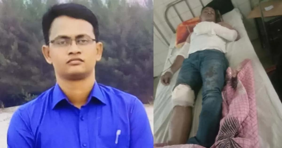 চাঁপাইনবাবগঞ্জে ডাকাতের ছুরিকাঘাতে এসআই গুরুতর আহত