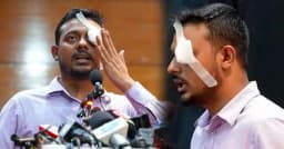 নাসীরুদ্দীন পাটওয়ারীর চোখে ব্যান্ডেজ, জানা গেল আসল কারণ