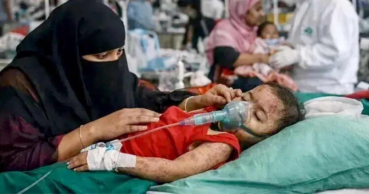 হামে আরও ৩ শিশুর মৃত্যু, বাড়ছে সংক্রমণ