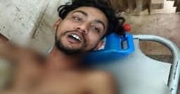 বাঘারপাড়ায় বাবার রামদার কোপে ছেলে জখম