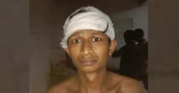মাদকবিরোধী অভিযানে যুবকের মাথা ফাটল, দায় নিচ্ছেন না এমপি-পুলিশ