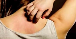 চুলকানি হতে পারে মারাত্মক রোগের লক্ষণ