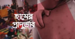 হামে ২৪ ঘণ্টায় প্রাণ গেল আরও ৭ শিশুর, মৃত্যু ৬০০ ছাড়াল