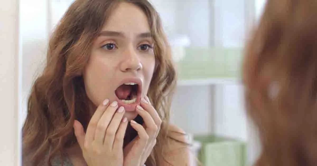 শীতের সময় ঠোঁট ও মুখে ঘা হয়? ঘরোয়াভাবেই মিলবে সবাধান