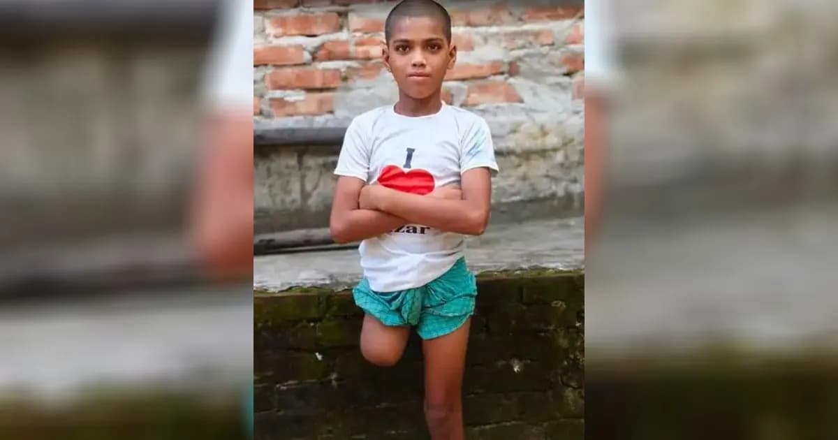 চক্রের ফাঁদে নয়, রায়হানের পা কাটা নিয়ে সামনে এলো ভিন্ন তথ্য