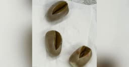 যাত্রীর পায়ুপথে লুকানো ১ কোটি ৭৪ লাখ টাকার স্বর্ণ