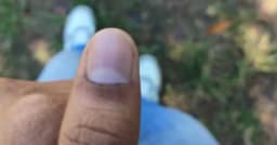 মুছে যাচ্ছে কালি, অভিযোগ দেবে ছাত্রদল