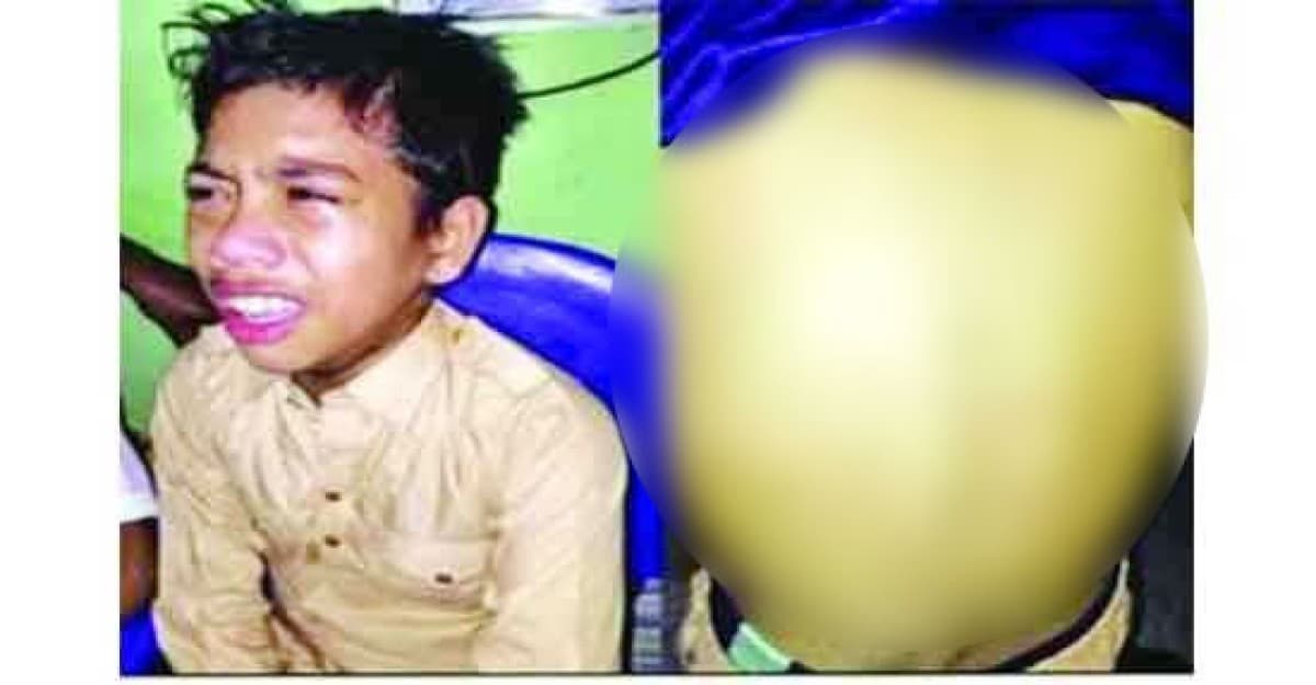 শিক্ষার্থীকে ‘ব্লেড দিয়ে খুঁচিয়ে মরিচের গুঁড়া’ লাগান শিক্ষক