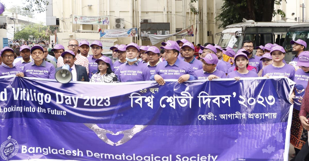 শ্বেতী রোগীদের মানসিকভাবে সাপোর্ট দিতে হবে: বিএসএমএমইউ উপাচার্য