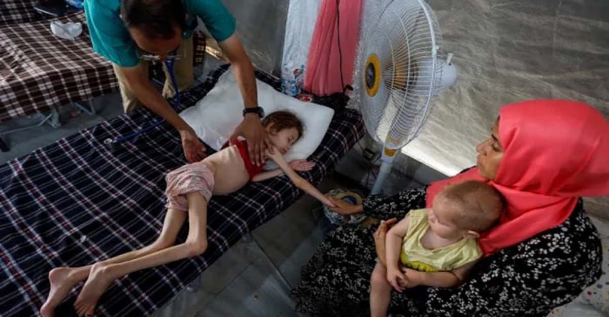 গাজায় অপুষ্টিতে ৬৬ শিশুর মৃত্যু