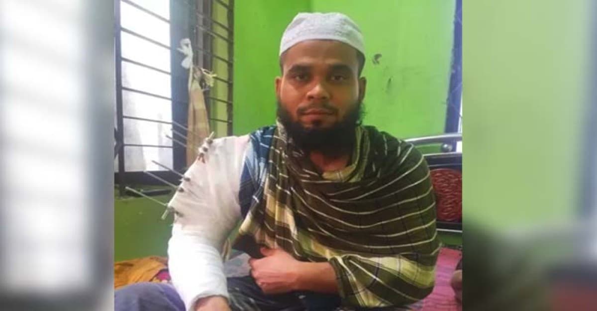 পিরোজপুরে পঙ্গুত্বের আশঙ্কায় দিন কাটছে  বেল্লালের