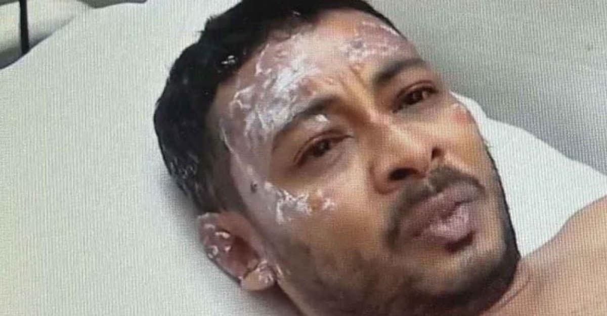 মাইলস্টোনে বিমান বিধ্বস্ত: আগুন থেকে বেঁচে ফেরা শিক্ষকের ভয়াবহ বর্ণনা