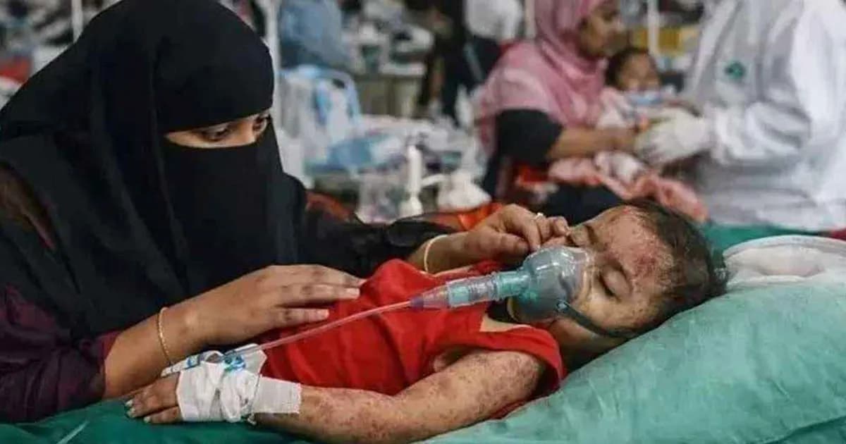 এক মাসে হাম উপসর্গে ২০৬ শিশুর মৃত্যু