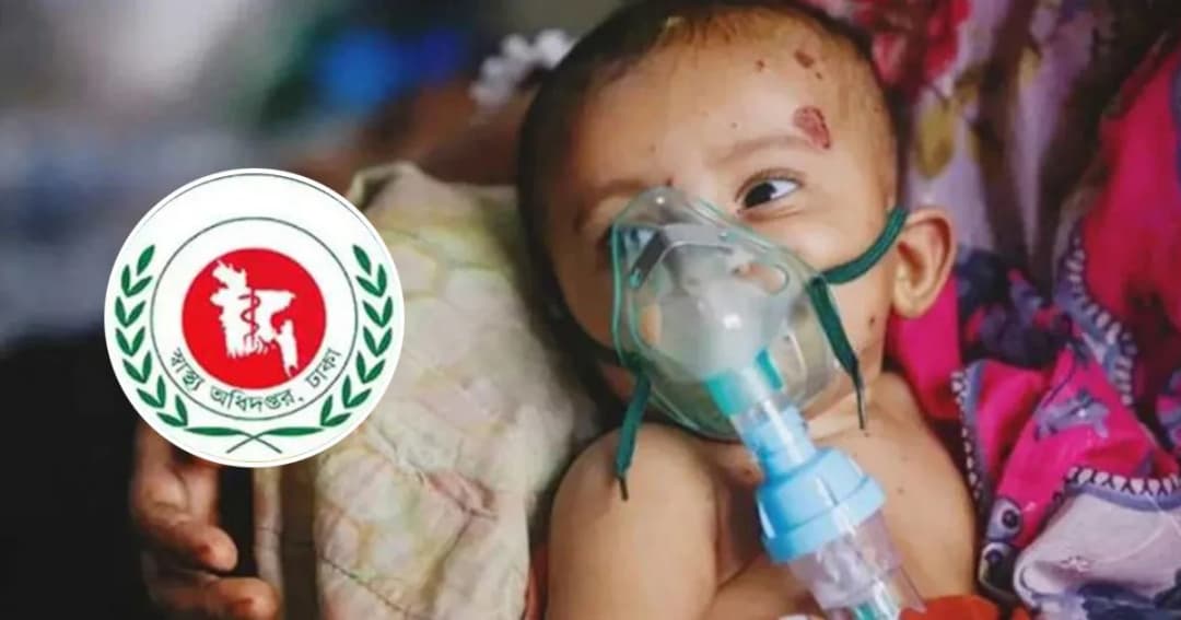 হামের উপসর্গে আরও ৩ শিশুর মৃত্যু, শনাক্ত ১১৩ জন