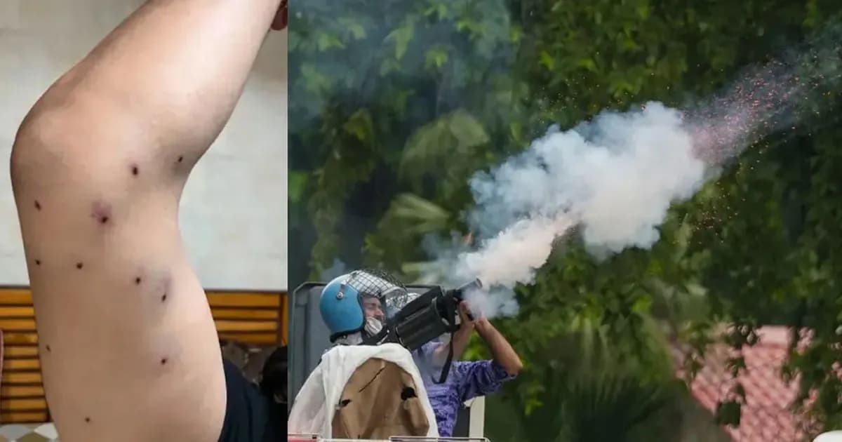 শিক্ষার্থীদের বিক্ষোভে ছররা গুলির অভিযোগ, অস্বীকার পুলিশের