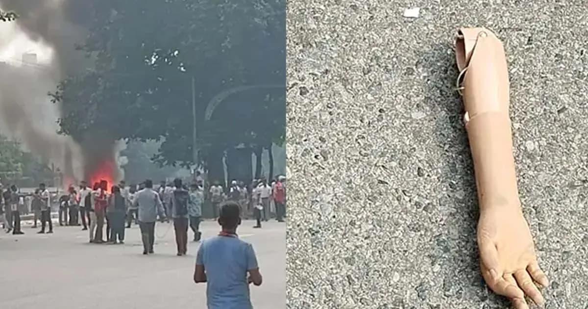 পুলিশের সঙ্গে সংঘর্ষ, সড়কে পড়েছিল জুলাই যোদ্ধার কৃত্রিম হাত
