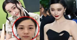 ১২ কোটি টাকা খরচে অভিনেত্রীর মতো চেহারা, বিপদে তরুণী