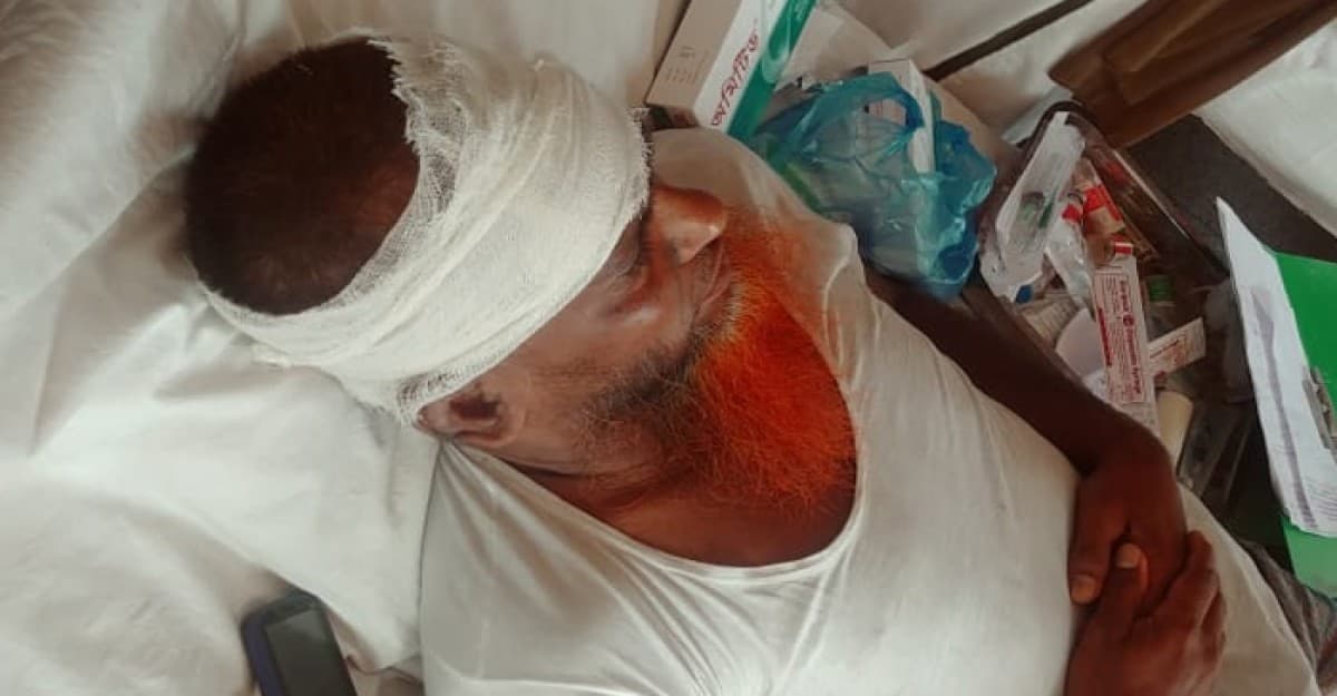 দুমকিতে জমিতে ডাল তোলা নিয়ে সংঘর্ষে আহত ৪