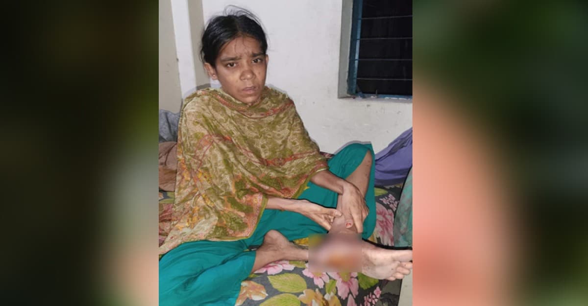 টাকার অভাবে পা হারাতে বসেছেন আকলি বেগম