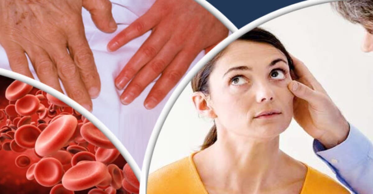 কিভাবে বুঝবেন রক্তশূন্যতায় ভুগছেন