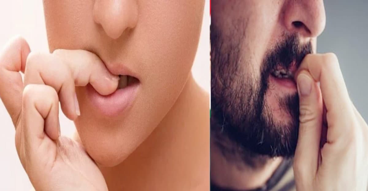 দাঁত দিয়ে নখ কাটা অভ্যাস নিয়ে যা জানাল বিশেষজ্ঞরা