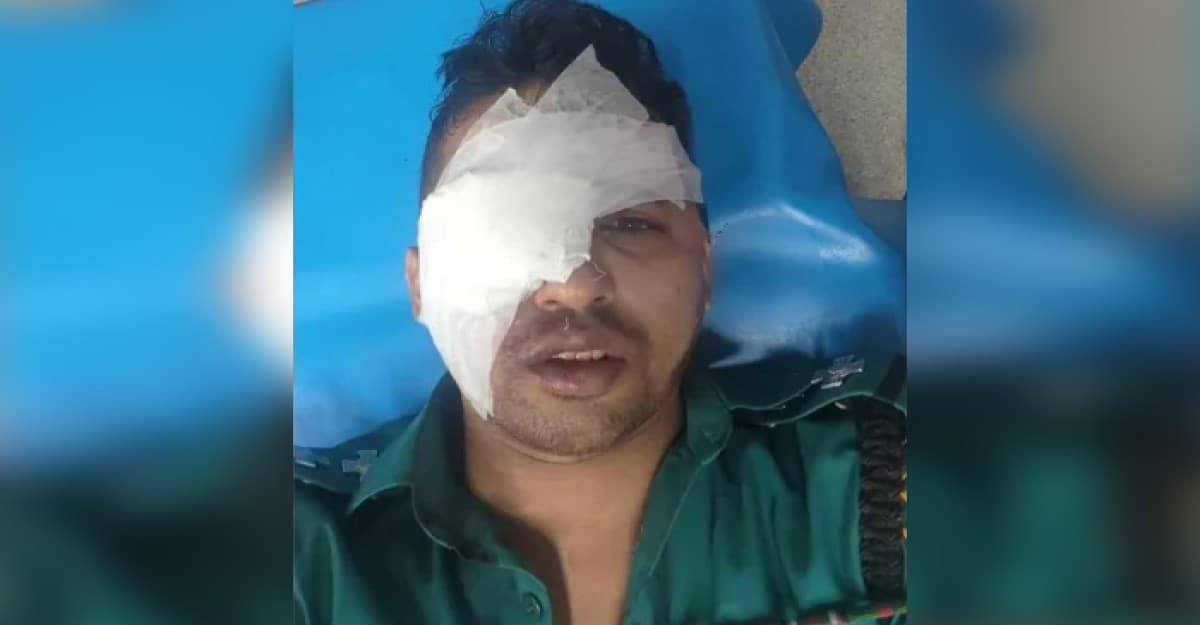 হিজড়াদের হামলায় চোখ হারালেন পুলিশের এসআই