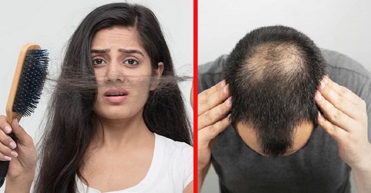 চুল কেন পড়ে? থামাবেন যেভাবে