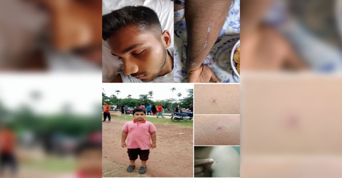 ছাত্র আন্দোলনে পুলিশের গুলিতে রেহাই পাইনি ৮ম শ্রেণীর শিক্ষার্থী মিয়াত আলম