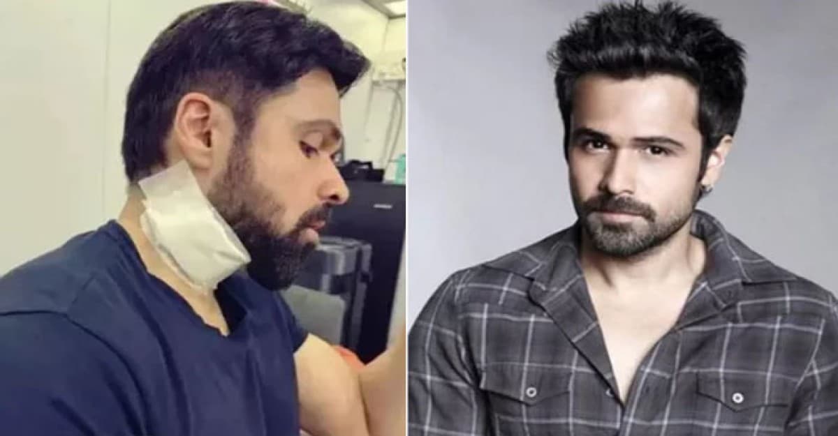 শুটিংয়ে গুরুতর আহত ইমরান হাশমি
