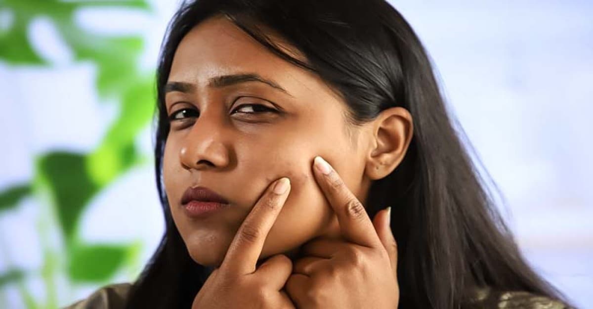 শীতে ব্রণ বাড়লে যা করবেন