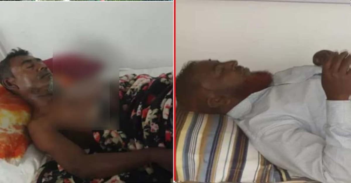 শার্শায় বিএনপি ২ নেতাকে পিটিয়ে জখম,বোমা ও গুলিবর্ষণ