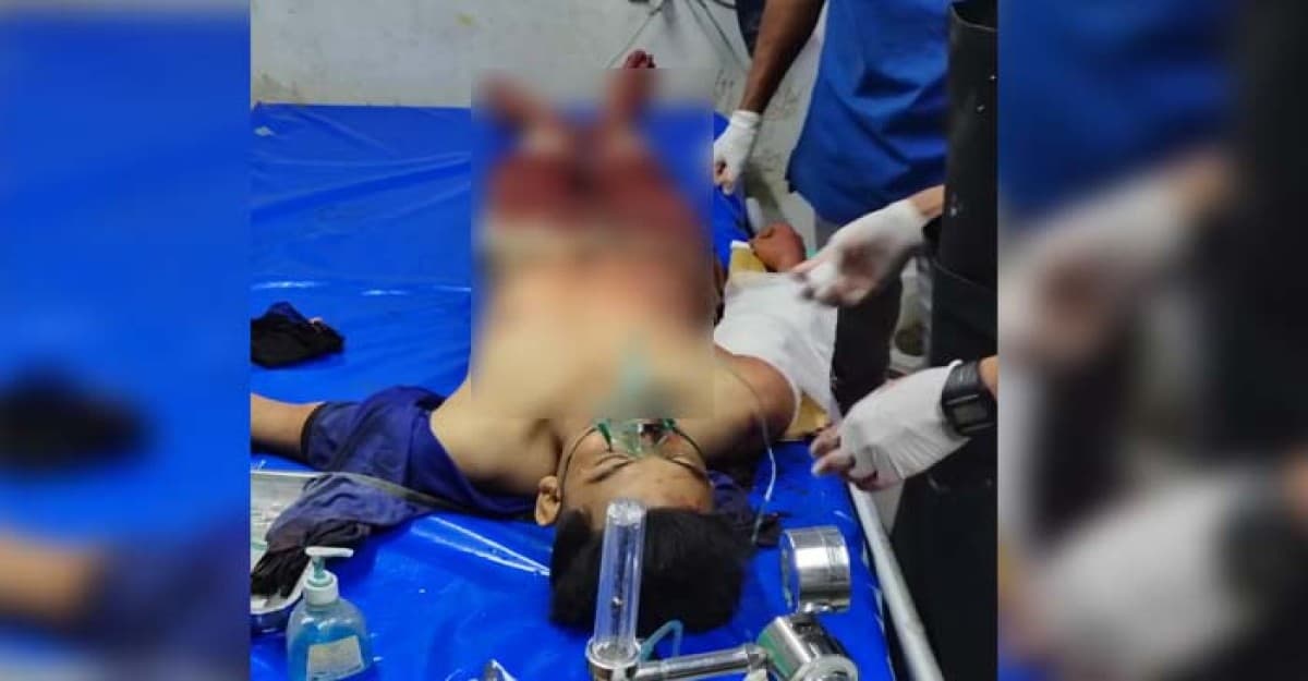 কক্সবাজারে অগ্নি-নির্বাপক সিলিন্ডার বিস্ফোরণে যুবকের মৃত্যু