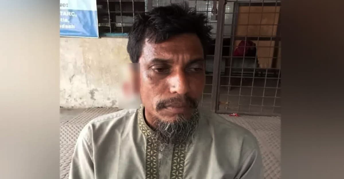 সিগারেট না পেয়ে দোকানির কান কামড়ে ছিঁড়ে দিলেন যুবক