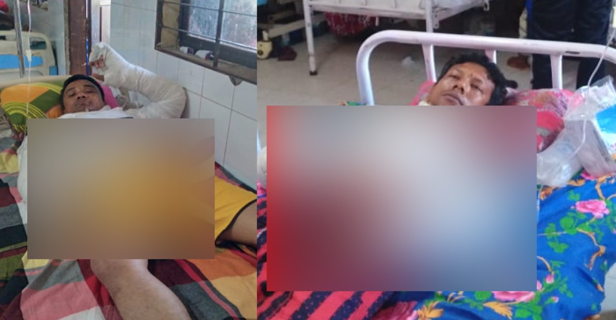 কক্সবাজারের রামুতে দুই যুবককে এসিড নিক্ষেপ