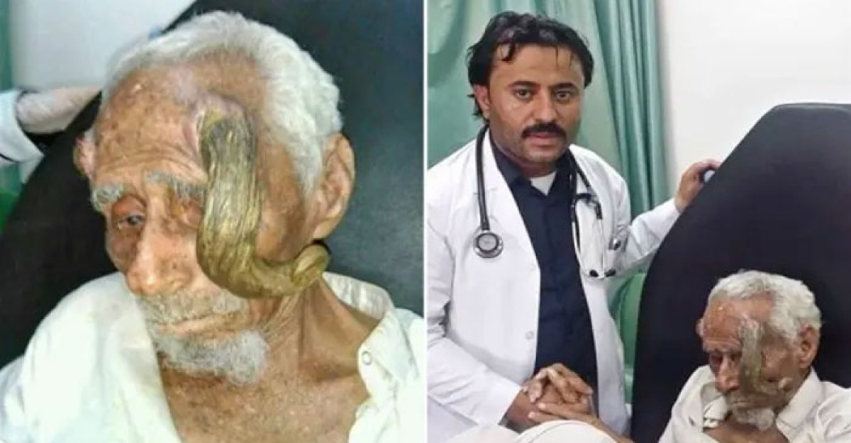 মাথার ‘শিং’ কেটে ফেলায় ১৪০ বছর বয়সী আলির মৃত্যু