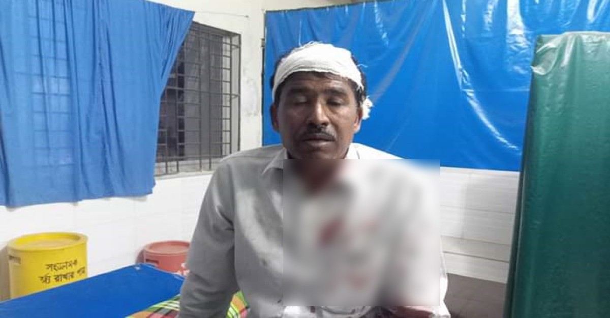 ভিজিডি কার্ডের টাকা না দেওয়ায় মাথা ফাটালেন ইউপি সদস্য