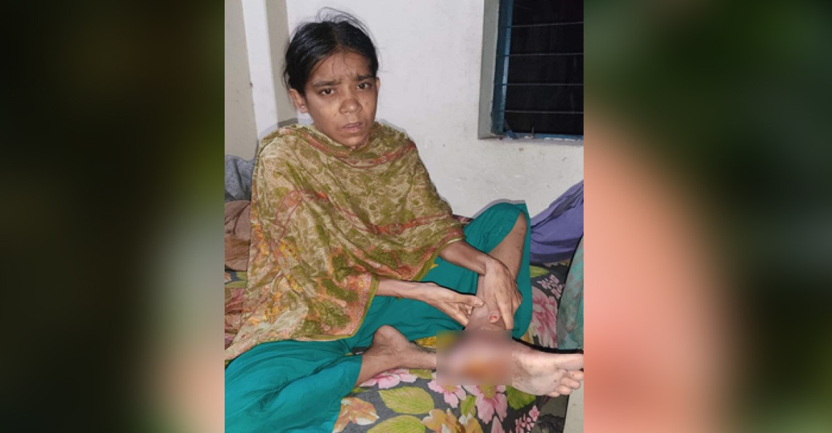 টাকার অভাবে পা হারাতে বসেছেন আকলি বেগম