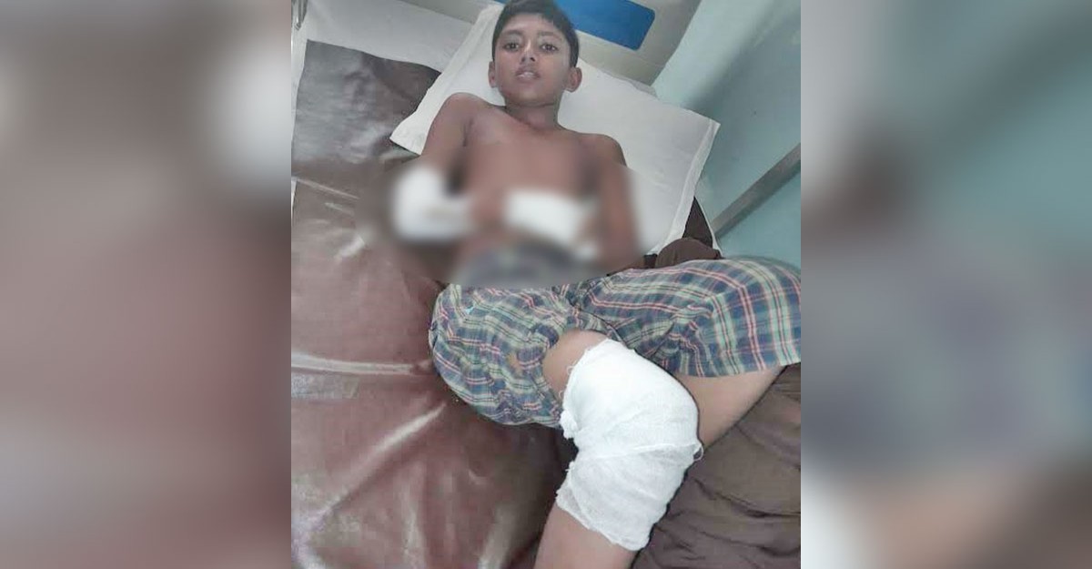 কয়রায় ট্রলির আঘাতে শিক্ষকসহ ২ স্কুল ছাত্র আহত