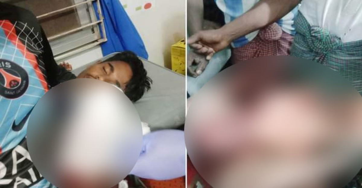 টেকনাফে হাতের কব্জি বিচ্ছিন্ন করে ২০ লাখ টাকা মুক্তিপন দাবি