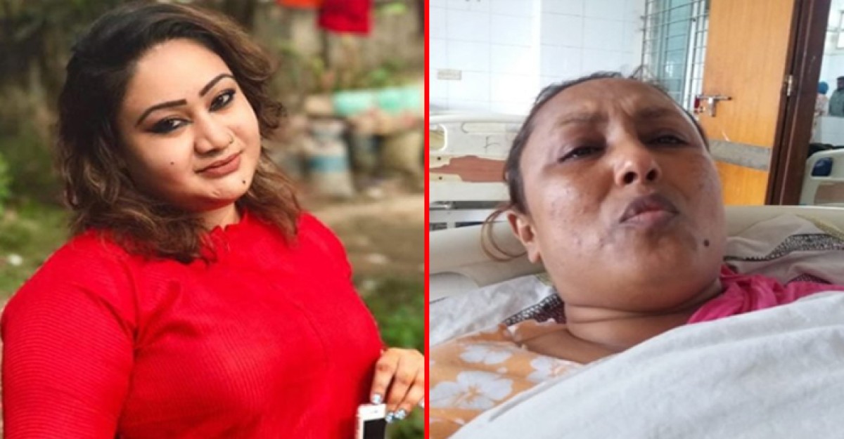 হাসপাতালে কাতরাচ্ছেন পাপিয়ার মারধরে আহত রুনা লায়লা